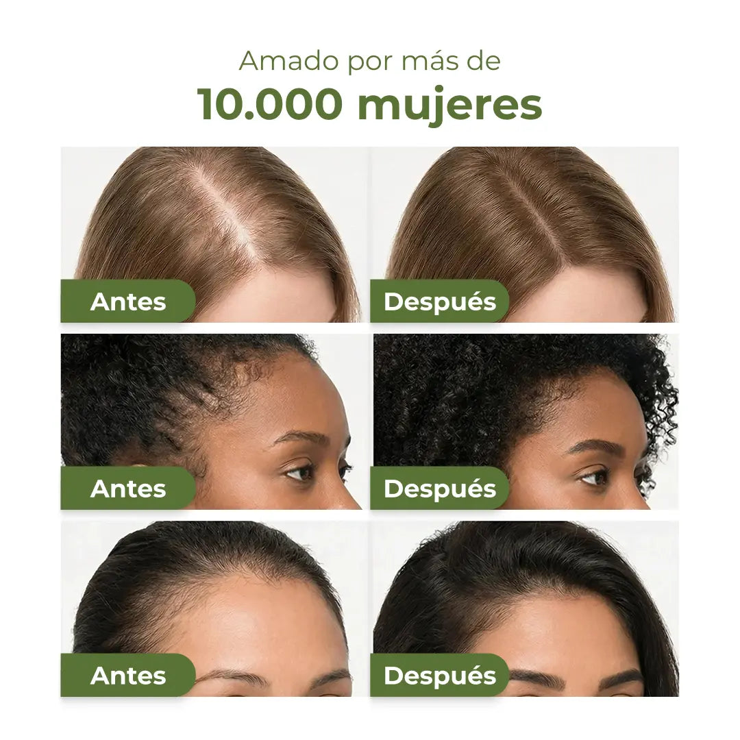 Frena la caída y recupera tu cabello en solo 60 segundos al día.