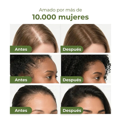 Frena la caída y recupera tu cabello en solo 60 segundos al día.