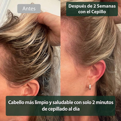 Vayose - Cepillo antigrasa para el cabello sin champú